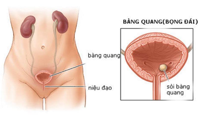 khám tiết niệu