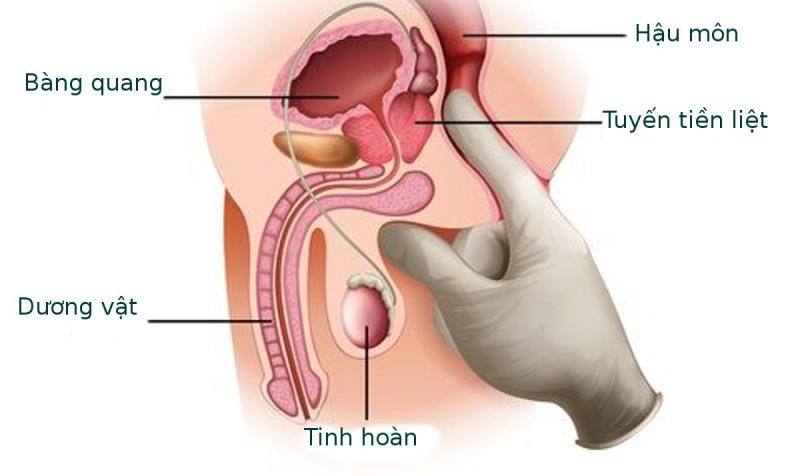 khám tiết niệu ở đâu