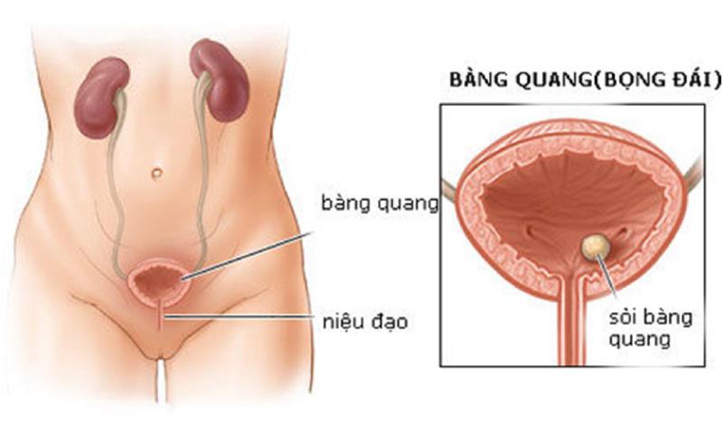 đi tiểu buốt ra máu khám ở đâu