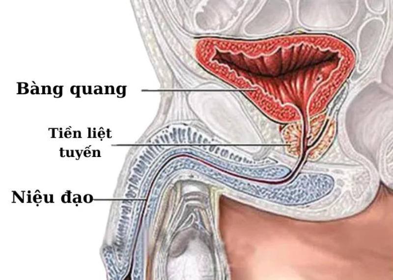 tiểu rắt ra máu sau khi quan hệ