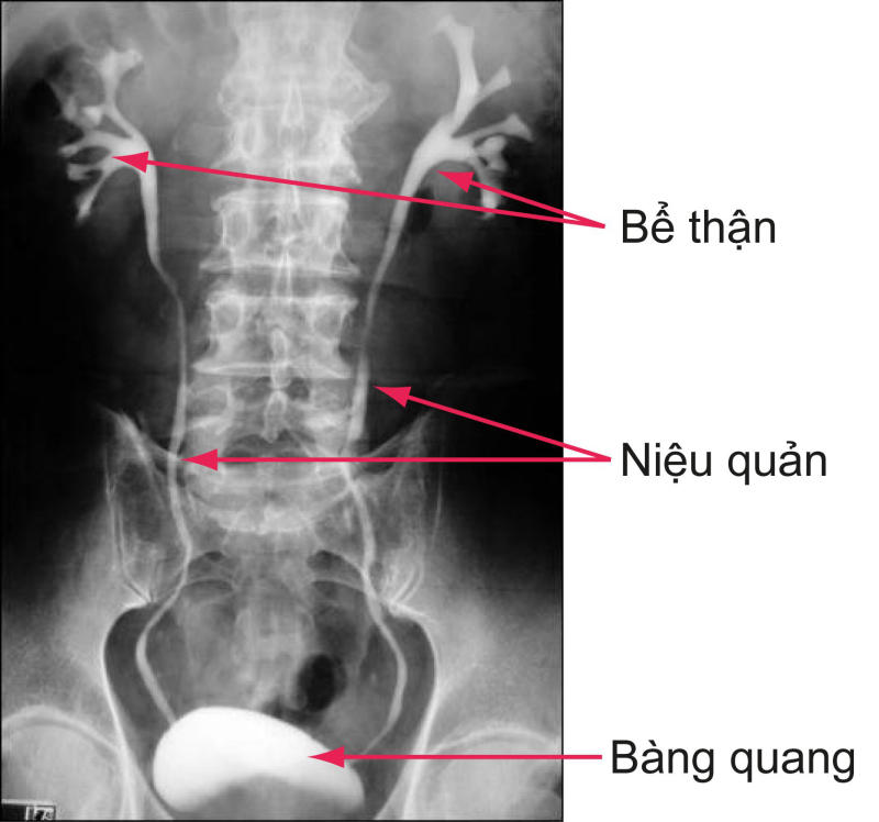 bàng quang thần kinh