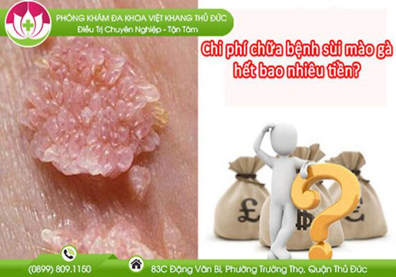 điều trị sùi mào gà bao nhiêu tiền