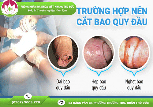 Nam giới nên cắt bao quy đầu trong những trường hợp nào?