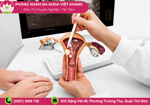 Tầm quan trọng của việc khám phụ khoa định kỳ